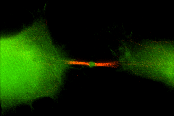 Midbody formed at the center of an intercellular bridge during telophase of the cell cycle.